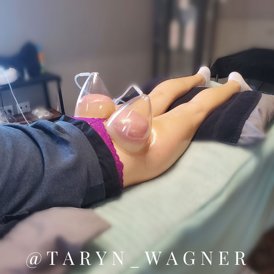 Vacuum Therapy Butt Lift by Taryn Wagner in Lodi, CA